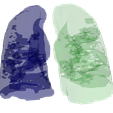 4.png 3D Model of Lungs Infected with Covid19