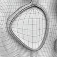 wfsub0006.jpg Fibroid Uterus Human female 3D
