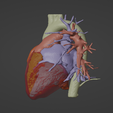 2.png 3D Model of Heart (from real patient)