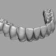 Captura-de-tela-2023-10-24-112857.png dental prosthesis
