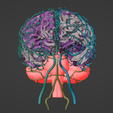 10.png 3D Model of Brain and Aneurysm