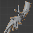 chd4_ultimaker.png.c4280492d01a9921f93e56c66fa89243.png 3D Model of Pulmonary Arteries (Fontan Procedure)