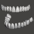 Model-E.png Aesthetic Tooth Libraries