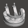 3.png Dental Models Articulated and Dental Bar