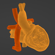 18.png 3D Model of Heart after Fontan Procedure