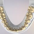 19.jpg 3D Dental Jaws Replica with Detachable Teeth