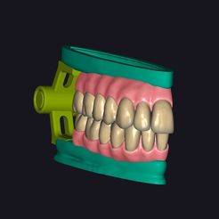 01.jpg Occlusion Teeth contact points