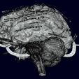 screenshot163.jpg Central nervous system cortex limbic basal ganglia stem cerebel 3D model