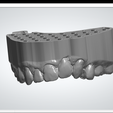 Vertices: 123853 Facets: 247702 3shape> PAA | @Preau> ‘SF en 18q Endodontic palate model