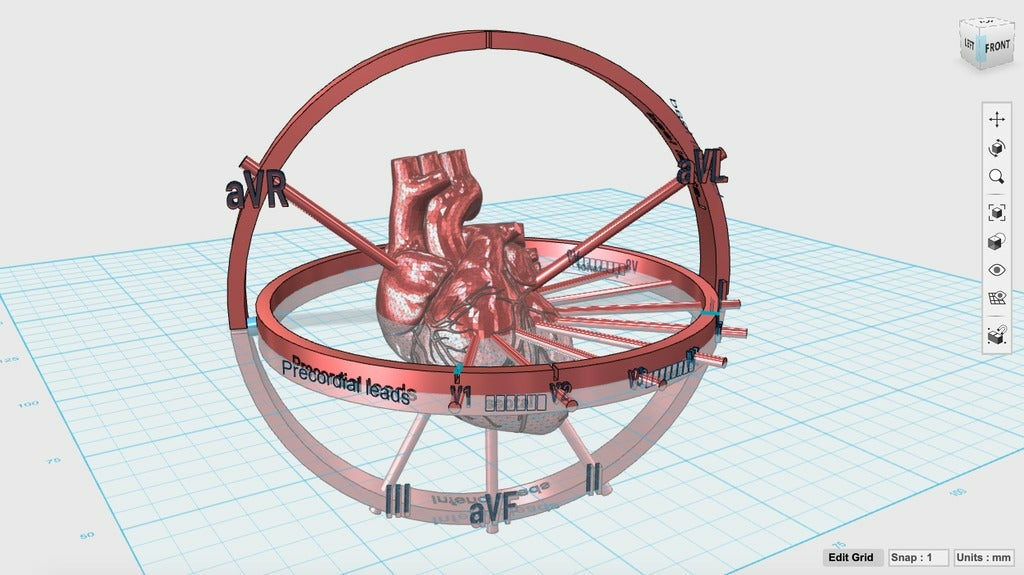 V3.png Free STL file ECG 3D Visualizer・3D print model to download, Lockheart