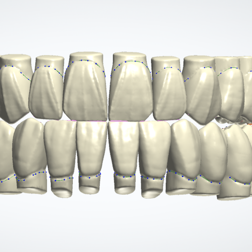 🦷 omer library,, 3shape teeth library ,,, ubber + lower・ 3D File for 3D ...