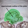 Approximate-outline-of-the-plate.jpeg A cranial plate to replace a skull defect (an example of a real operation 2)