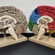 1687378174382.jpg Brain for human anatomy study, Split hemispheres + support.