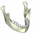 13.jpg mandible with teeth