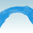 Screenshot_24.png Digital Full Coverage Occlusal Splint with Canine Guidance