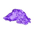 STL00001.stl Model of human heart with pulmonary atresia (PuA) - generated from real patient