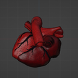 w2.png 3D Model of Heart with Atrial Septal Defect