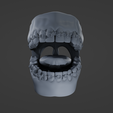 M9.png Mouth with Braces