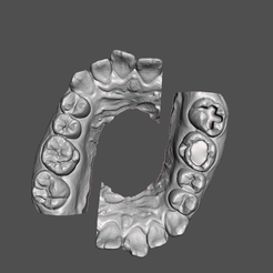Dental-Training-1.png STL file Training Teeth for Dental Students Black Dental Caries Classification・3D printer model to download