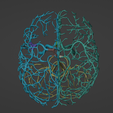23.png 3D Model of Brain and Aneurysm