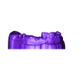 PreparationScan.stl STL file Digital Dental Custom Impression Tray・Template to download and 3D print