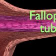 0003.jpg Fibroid Uterus Human female 3D