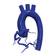 3.png 3D Model of Aorta and Coronary Arteries - 6pack