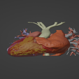 1.png 3D Model of Human Heart with Mirror Dextrocentric - generated from real patient