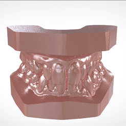 Screenshot_21.png Digital Study Orthodontic Archman Model