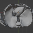 12.png 3D Model of Heart in Thorax