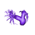 STL00007.stl 3D Model of Human Heart with Anomalous Pulmonary Venous Drainage (APVC) - generated from real patient