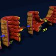 as2.jpg 3D Angiogenesis NEW BLOOD VESSEL FORMATION