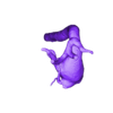 STL00006.stl 3D Model of Human Heart with Common Arterial Trunk (CAT) - generated from real patient