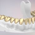 21.jpg 3D Dental Jaws Replica with Detachable Teeth