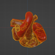 uv2.png 3D Model of Heart with Atrial Septal Defect