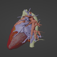 9.png 3D Model of Heart (from real patient)