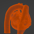 10.png 3D Model of Heart with Tetralogy of Fallot (ToF)