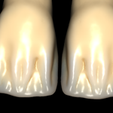 preview-cutback-facial-ridges.png All Collection For exocad