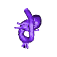 2. vsdobjaorta_and_heart.stl Congenital Heart Disease - 7pack