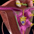 36.jpg Fibroid Uterus Human female 3D