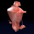 0022.jpg Fibroid Uterus Human female 3D