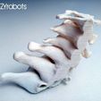cervical035n.jpg 3D printed Cervical Spine