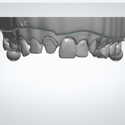 Screenshot_14.png 带功能关节器接口的数字切面模型