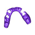 789513050_20240418_1129_Tech_01_Sh_Vi_D_flex_A1_1.stl DIGITAL LOWER PARTIAL REMOVABLE DENTURE - flexible