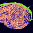 screenshot152.jpg Central nervous system cortex limbic basal ganglia stem cerebel 3D model