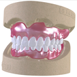 1.png Digital Full Dentures with Combined Glue-in Teeth Arch