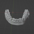3.png Dental models with removable dies