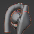 9.png 3D Model of Heart with Tetralogy of Fallot (ToF)