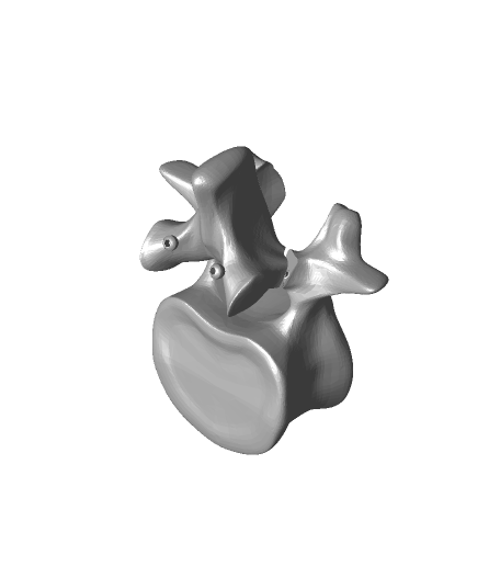 Spondy_single_level_pars_repair_demo_model.png Spondy single level pars repair demo  model.stl