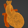26.png 3D Model of Heart after Fontan Procedure